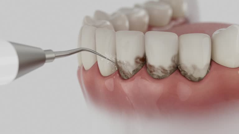 Reliable Dental contractor in Johnson City, TN by Dentist Open Now